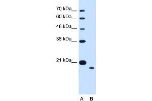 WB Suggested Anti-TMEM91 Antibody Titration:  1.