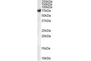 Image no. 1 for anti-Syntaxin Binding Protein 1 (STXBP1) (C-Term) antibody (ABIN374370) (STXBP1 Antikörper  (C-Term))