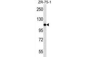 Western Blotting (WB) image for anti-USO1 Homolog, Vesicle Docking Protein (USO1) antibody (ABIN2997687) (USO1 Antikörper)
