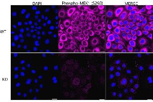 Immunocytochemical staining of HeLa cells using Phospho-MEK1 (S298) antibody (ABIN7799462), 1:1,000), Top panel: wild-type (WT), Bottom panal: Phospho-MEK1 (S298) shRNA knockdown (KD). (Rekombinanter MEK1 Antikörper  (pSer298))