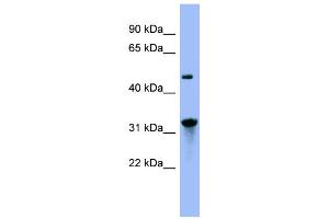 WB Suggested Anti-NIT1 Antibody Titration: 0. (Nitrilase 1 Antikörper  (N-Term))