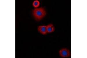 Immunofluorescent analysis of CLIP3 staining in A549 cells. (CLIP3 Antikörper)