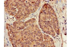 Immunohistochemistry (IHC) image for anti-Guanine Nucleotide Binding Protein (G Protein), beta 5 (GNB5) (AA 1-353) antibody (ABIN7154745)