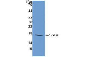 Western blot analysis of recombinant Rat LAMa1. (Laminin alpha 1 Antikörper  (AA 1156-1276))