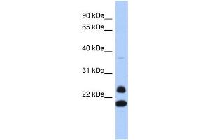 WB Suggested Anti-NEUROG2 Antibody Titration:  0. (Neurogenin 2 Antikörper  (N-Term))