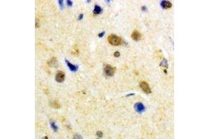 Immunohistochemical analysis of S100-A1 staining in human brain formalin fixed paraffin embedded tissue section. (S100A1 Antikörper)