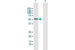 Western Blot analysis of UGT2B15 expression in transfected 293T cell line by UGT2B15 MaxPab polyclonal antibody. (UGT2B15 Antikörper  (AA 1-530))