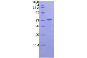 SDS-PAGE analysis of Mouse CD163 Protein.