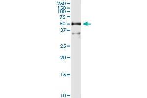 ALDH3A1 (Human) IP-WB Antibody Pair