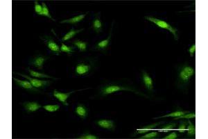 Immunofluorescence of purified MaxPab antibody to MYD88 on HeLa cell. (MYD88 Antikörper  (AA 1-296))