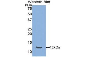 Western blot analysis of the recombinant protein. (Peptide YY Antikörper  (AA 30-98))