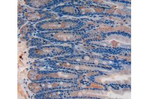 IHC-P analysis of Rat Intestine Tissue, with DAB staining. (SIRT2 Antikörper  (AA 28-303))