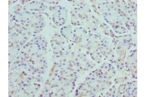 Immunohistochemistry of paraffin-embedded human pancreatic tissue using ABIN7145930 at dilution of 1:100 (CCR4 Antikörper  (AA 309-360))