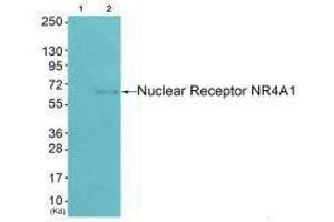 Western blot analysis of extracts from HepG2 cells (Lane 2), using Nuclear Receptor NR4A1 (Ab-351) antiobdy. (NR4A1 Antikörper  (Ser351))