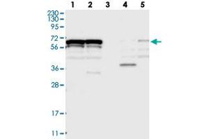 Western blot analysis of Lane 1: RT-4, Lane 2: U-251 MG, Lane 3: Human Plasma, Lane 4: Liver, Lane 5: Tonsil with ZNF655 polyclonal antibody  at 1:250-1:500 dilution. (ZNF655 Antikörper)