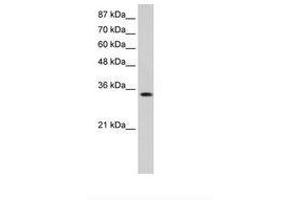 Image no. 2 for anti-Muscleblind-like Protein 1 (MBNL1) (AA 211-260) antibody (ABIN6736245) (MBNL1 Antikörper  (AA 211-260))