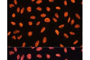 Immunofluorescence (IF) image for anti-Chromodomain Helicase DNA Binding Protein 4 (CHD4) antibody (ABIN7255670)