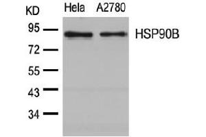 Image no. 3 for anti-Heat Shock Protein 90kDa alpha (Cytosolic), Class B Member 1 (HSP90AB1) (Ser254) antibody (ABIN197569) (HSP90AB1 Antikörper  (Ser254))