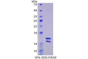 SDS-PAGE (SDS) image for Interleukin 23, alpha subunit p19 (IL23A) (AA 20-189) protein (His tag) (ABIN2121449)