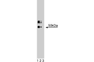 Western blot analysis of HDAC3 on a human endothelial cell lysate. (HDAC3 Antikörper  (AA 309-425))