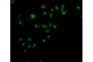 Immunofluorescence staining of Hela cells with ABIN7144542 at 1:110,counter-stained with DAPI. (ALOX5 Antikörper  (AA 2-149))