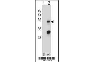 Western blot analysis of HAT1 using rabbit polyclonal HAT1 Antibody using 293 cell lysates (2 ug/lane) either nontransfected (Lane 1) or transiently transfected (Lane 2) with the HAT1 gene.