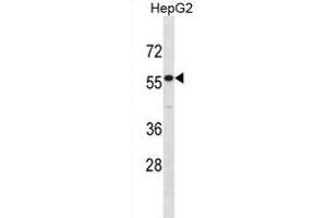 IL17RE Antibody (N-term) (ABIN1881455 and ABIN2838728) western blot analysis in HepG2 cell line lysates (35 μg/lane).