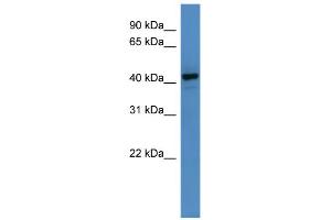 WB Suggested Anti-RNF128 Antibody Titration: 0. (RNF128 Antikörper  (C-Term))
