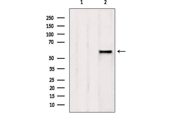 AHCYL1 Antikörper  (N-Term)