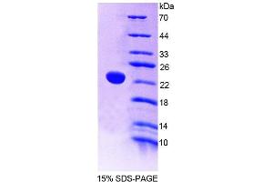 SDS-PAGE (SDS) image for Protein tyrosine Phosphatase, Receptor Type, E (PTPRE) (AA 346-500) protein (His tag) (ABIN4989881) (PTPRE Protein (AA 346-500) (His tag))