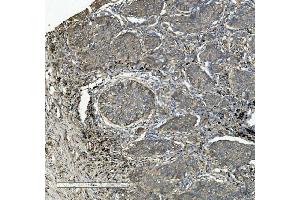 IHC analysis of Integrin beta 5/ITGB5 using anti-Integrin beta 5/ITGB5 antibody (ABIN7601319).