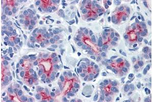 Human Breast (formalin-fixed, paraffin-embedded) stained with MUC1 antibody ABIN337385 at 10 ug/ml followed by biotinylated goat anti-rabbit IgG secondary antibody ABIN481713, alkaline phosphatase-streptavidin and chromogen. (MUC1 Antikörper  (C-Term))