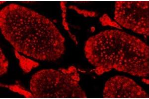 IF analysis of SAE1 using anti-SAE1 antibody (ABIN7601346). (SAE1 Antikörper  (AA 33-299))