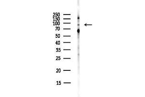 anti-Zinc Fingers and Homeoboxes 2 (ZHX2) (C-Term) antibody