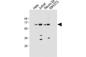 All lanes : Anti-SD4 Antibody  at 1:1000 dilution Lane 1: Hela whole cell lysate Lane 2: Jurkat whole cell lysate Lane 3: Neuro-2a whole cell lysate Lane 4: NIH/3T3 whole cell lysate Lysates/proteins at 20 μg per lane.
