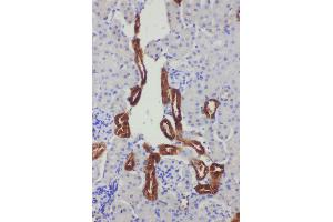 Anti-Kallikrein 1 antibody, IHC(P) IHC(P): Mouse Kidney Tissue (Kallikrein 1 Antikörper  (C-Term))