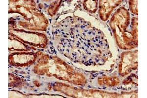 Immunohistochemistry (IHC) image for anti-Complement Component 1, Q Subcomponent, A Chain (C1QA) (AA 26-125) antibody (ABIN7148332)