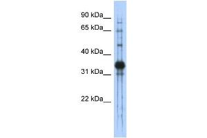 WB Suggested Anti-CHAD Antibody Titration: 0.