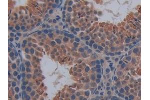 Immunohistochemistry (IHC) image for anti-Caspase 12 (Gene/pseudogene) (CASP12) (AA 1-413) antibody (ABIN7442993)