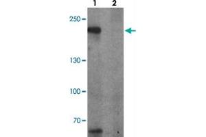 Western blot analysis of TET3 in SK-N-SH cell lysate with TET3 polyclonal antibody  at 1 ug/ml in (1) the absence and (2) the presence of blocking peptide. (TET3 Antikörper  (AA 1520-1570))