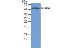 Western blot analysis of Rat Liver Tissue. (IL-6 Receptor Antikörper  (AA 19-10))