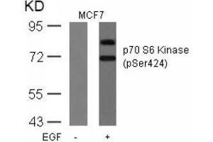 Image no. 3 for anti-Ribosomal Protein S6 Kinase, 70kDa, Polypeptide 1 (RPS6KB1) (pSer424) antibody (ABIN197052) (RPS6KB1 Antikörper  (pSer424))