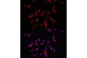 Immunofluorescence analysis of C6 cells using TMEM11 antibody (ABIN7270952) at dilution of 1:100. (TMEM11 Antikörper  (AA 1-80))
