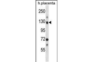 Western blot analysis in human placenta tissue lysates (35ug/lane). (NEK9 Antikörper  (AA 503-530))