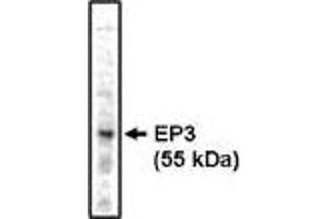 Western blot analysis using EP3 antibody on bovine brain lysate at 1 µg/ml. (PTGER3 Antikörper)