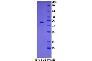 SDS-PAGE analysis of General STAT3 Protein. (STAT3 Protein)