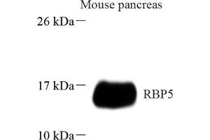 Western blot analysis of RBP5 (ABIN7075410) at dilution of 1: 1000 (Retinol Binding Protein 5 Antikörper)