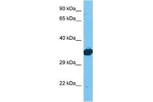 Host:  Rabbit  Target Name:  LDHB  Sample Tissue:  Human 293T Whole Cell  Antibody Dilution:  1ug/ml (LDHB Antikörper  (C-Term))