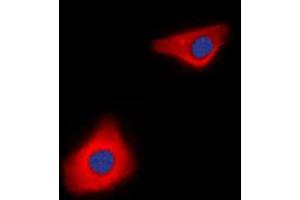 Immunofluorescent analysis of Caspase 10 staining in Jurkat cells. (Caspase 10 Antikörper  (C-Term))