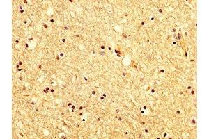 IHC image of ABIN7175618 diluted at 1:200 and staining in paraffin-embedded human brain tissue performed on a Leica BondTM system. (KCNAB1 Antikörper  (AA 287-401))